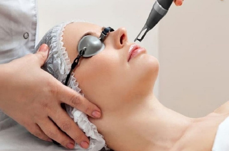 điều trị thâm môi bằng laser