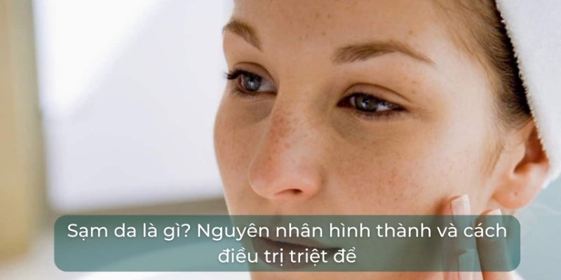 sạm da và cách điều trị