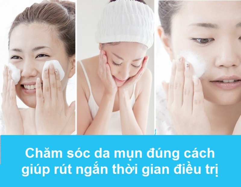 thời gian điều trị mụn là bao lâu